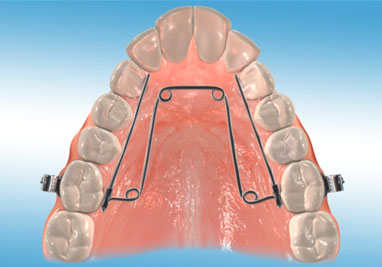 orthodontic appliances