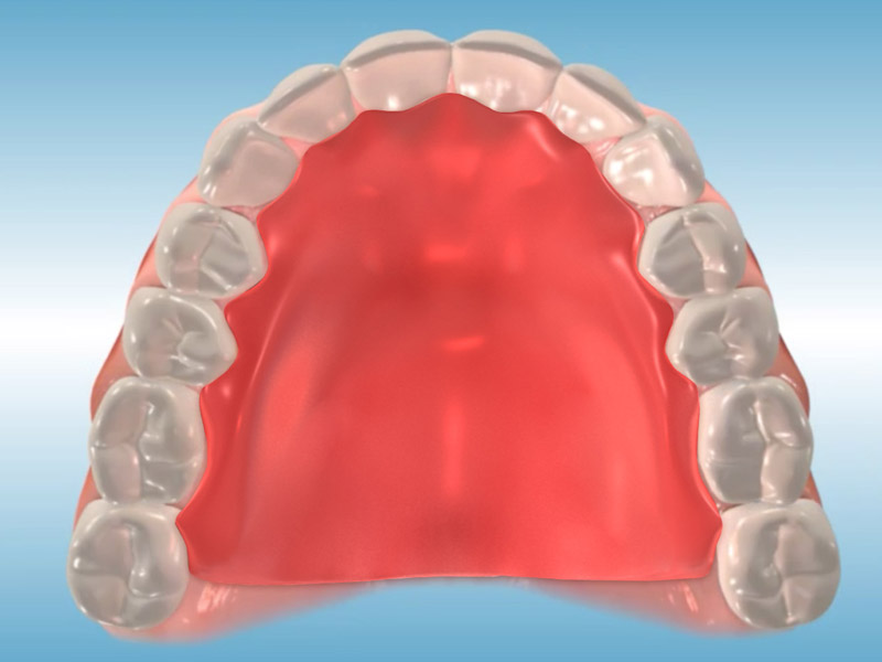 orthodontic appliances