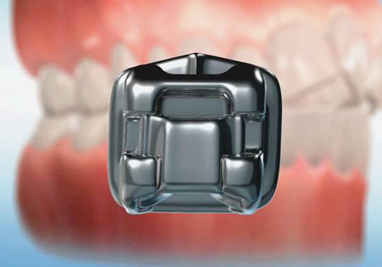 orthodontic appliances