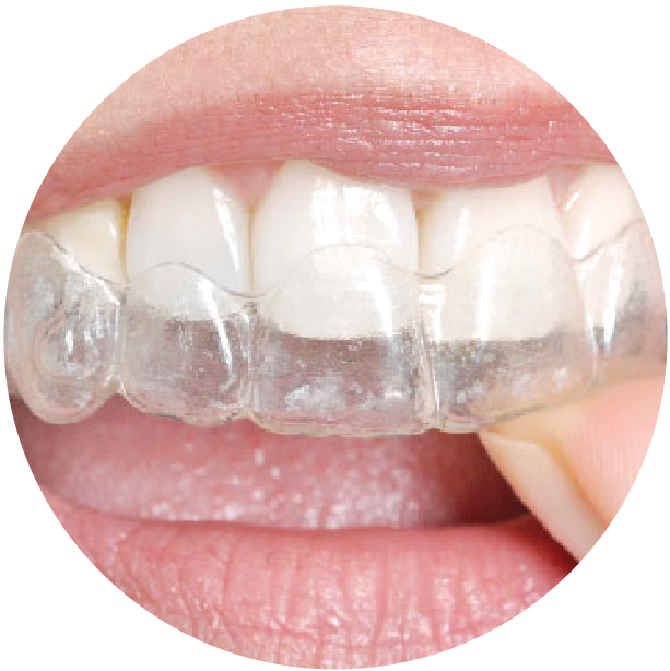 invisalign-c.png