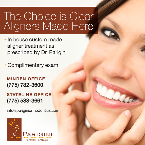 Clear Aligners