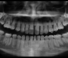 orthodontic terms